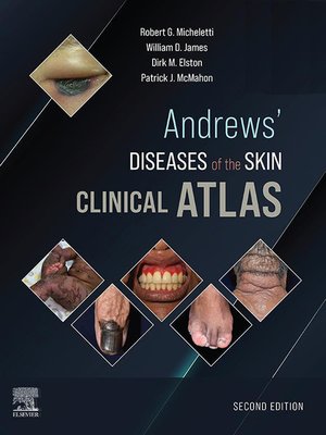cover image of Andrews' Diseases of the Skin Clinical Atlas,E-Book